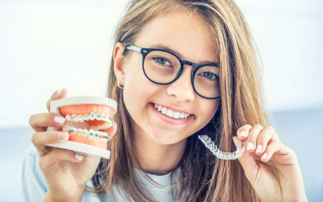 Invisalign or Braces: Setting The Record Straight